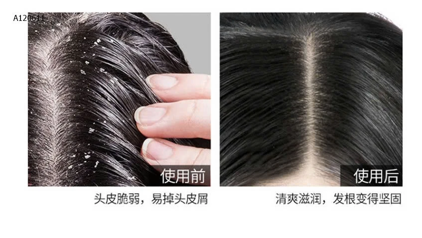 XỊT KÍCH THÍCH MỌC TÓC  ĐỒNG NHÂN ĐƯỜNG - sỉ 62k