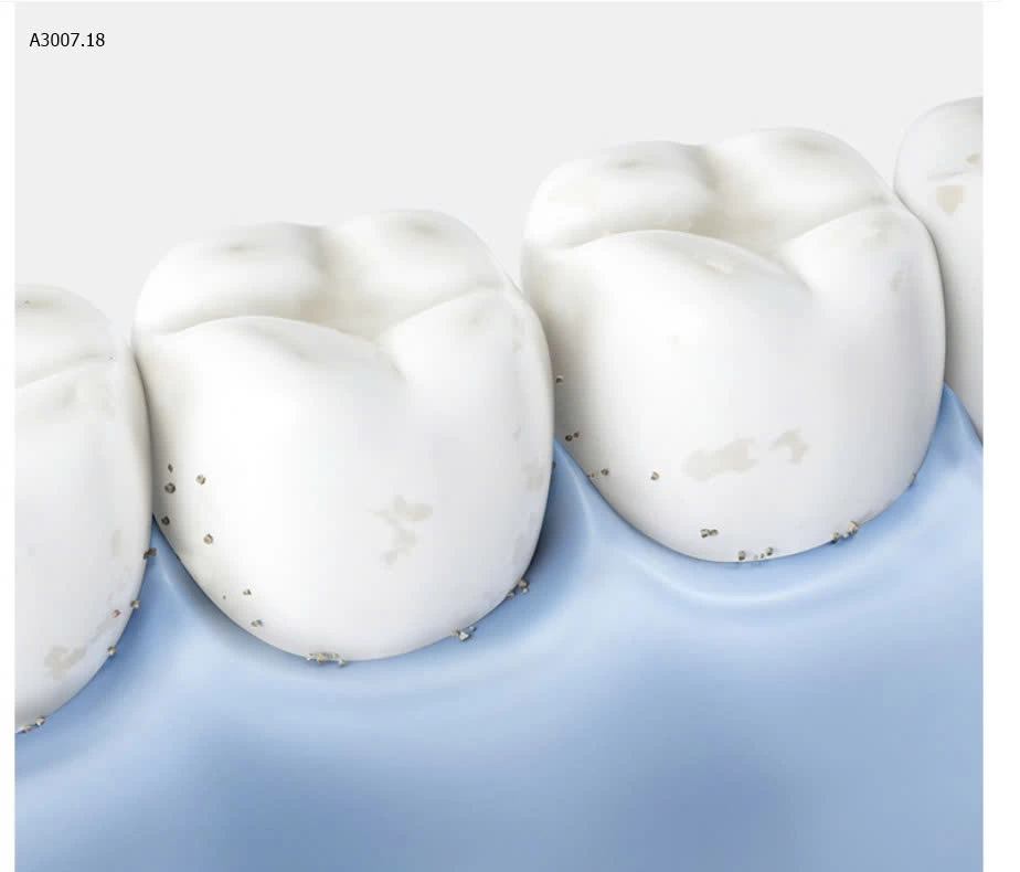 SET 200C TĂM CHỈ NHA KHOA - Sỉ 84k/1 set 200 chiếc