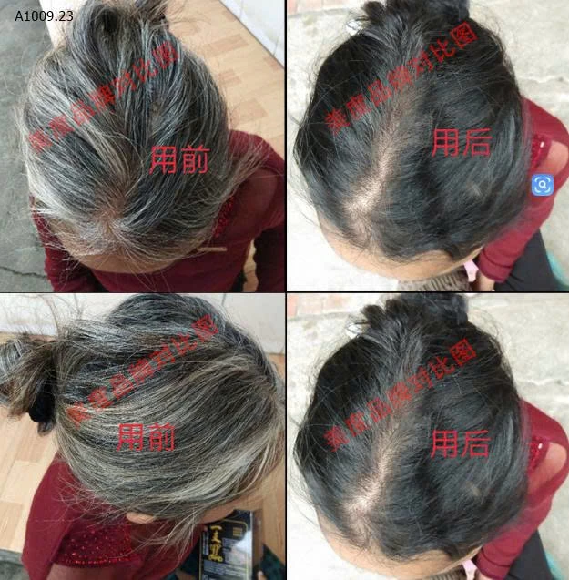  DẦU GỘI ĐEN TÓC- sỉ 85k